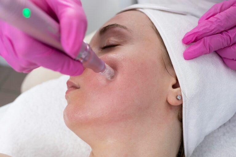 Tratamiento facial Dermapen en A Coruña